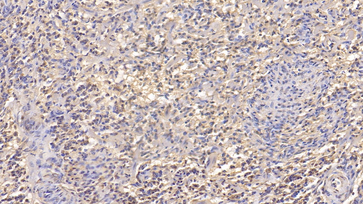 Monoclonal Antibody to Interleukin 2 Receptor Beta (IL2Rb) MAA229Hu22
