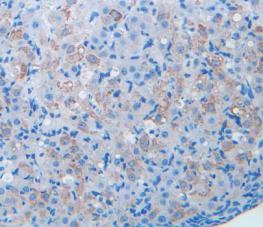 Polyclonal Antibody to Brain Derived Neurotrophic Factor (BDNF)