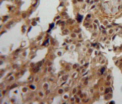 Polyclonal Antibody to Cyclophilin A (CYPA)
