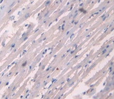 Polyclonal Antibody to Collagen Type XVIII (COL18)