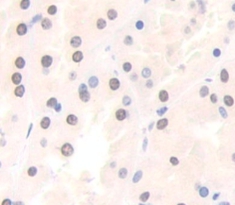 Polyclonal Antibody to Peroxisome Proliferator Activated Receptor Gamma Coactivator 1 Alpha (PPARgC1a)