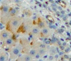 Polyclonal Antibody to Cluster Of Differentiation 8b (CD8b)