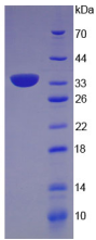 Active Connective Tissue Growth Factor (CTGF)