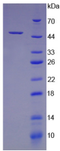 Active Colony Stimulating Factor 2, Granulocyte Macrophage (GMCSF)