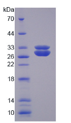 Active Superoxide Dismutase 3, Extracellular (SOD3)