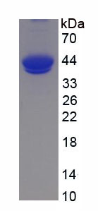 Active Complement Component 5a C5a Apa388hu61 Homo Sapiens Human Cloud Clone Corp Ccc