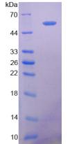 Active 5'-Nucleotidase, Ecto (NT5E)