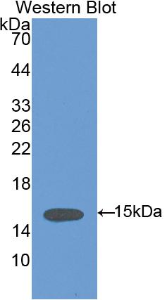 Anti-Vinculin (VCL) Polyclonal Antibody