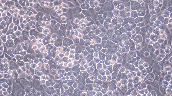 Primary Mouse Articular Chondrocytes (AC)