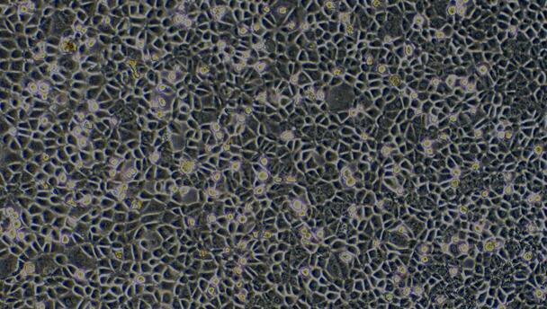 Primary Mouse Bronchial Epithelial Cells (BEpiC)