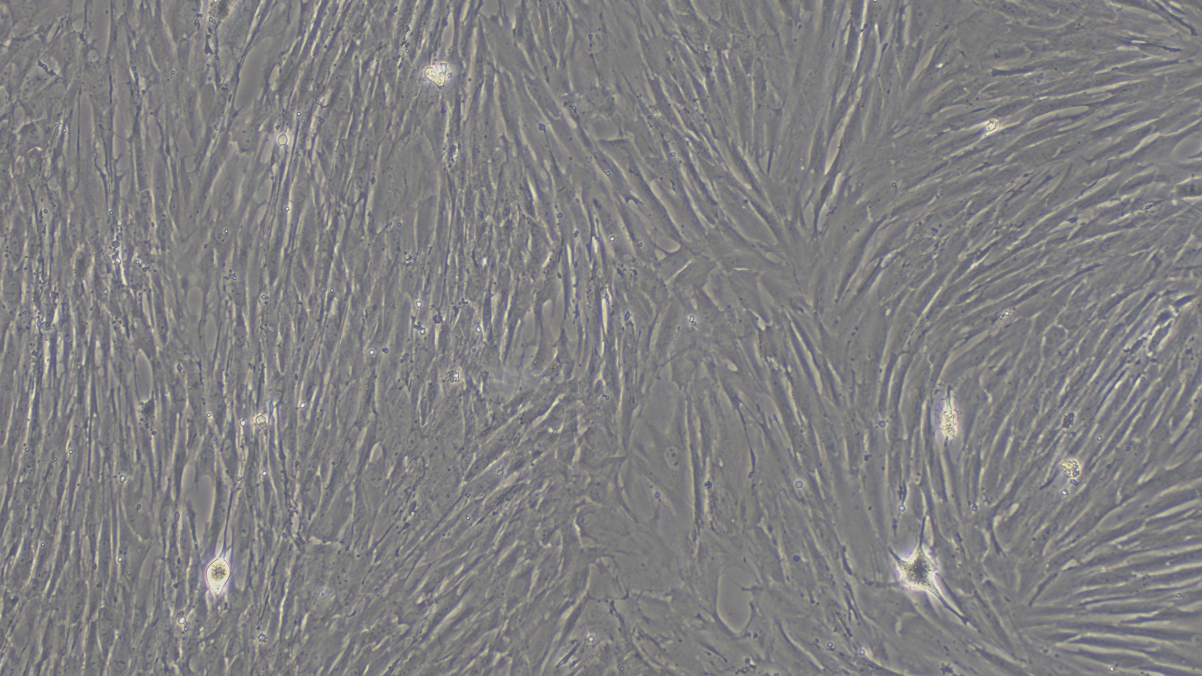 Primary Mouse Bladder Stromal Fibroblasts (BSF)
