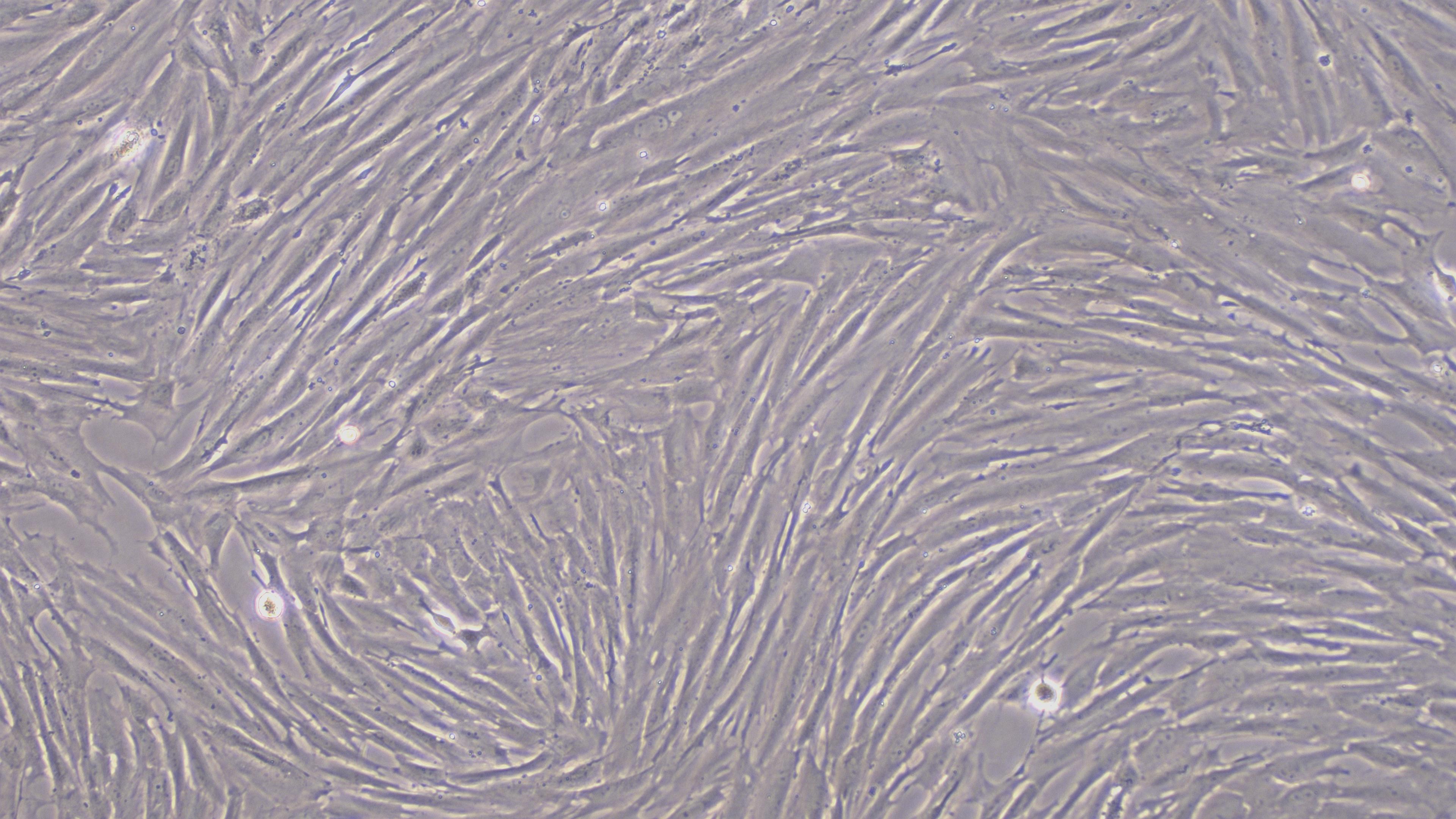 Primary Rat Bladder Stromal Fibroblasts (BSF)