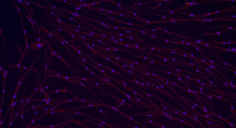 Primary Mouse Trigeminal ganglion neuron cells (TGN)