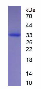 Eukaryotic Elastase 2, Neutrophil (ELA2)