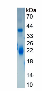 Eukaryotic Thrombin/Antithrombin Complex (TAT)