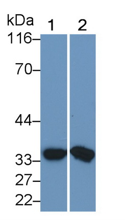 Monoclonal Antibody to Matrix Metalloproteinase 7 (MMP7)