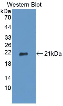 Monoclonal Antibody to Tumor Necrosis Factor Alpha (TNFa)