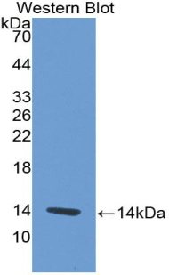 Monoclonal Antibody to Platelet Factor 4 (PF4)