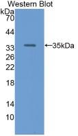 Monoclonal Antibody to Retinol Binding Protein 3, Interstitial (RBP3)