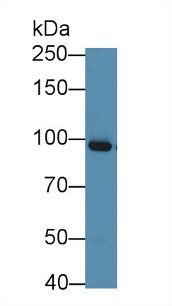Monoclonal Antibody to Gelsolin (GS)
