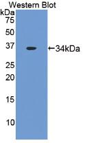 Monoclonal Antibody to Tissue Factor (TF)
