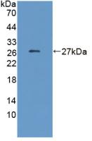 Monoclonal Antibody to C Reactive Protein (CRP)