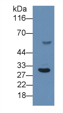 Monoclonal Antibody to C Reactive Protein (CRP)