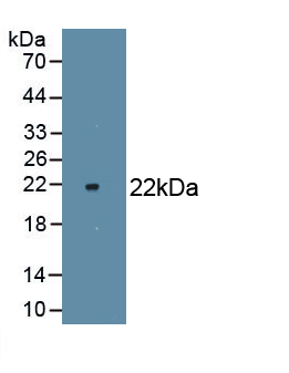 Monoclonal Antibody to Nitric Oxide Synthase 2, Inducible (NOS2)