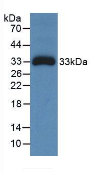Monoclonal Antibody to Ceruloplasmin (CP)