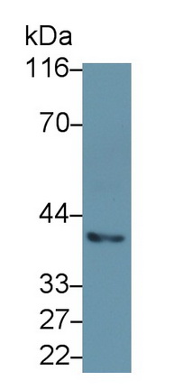 Monoclonal Antibody to Keratin 19 (KRT19)