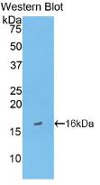 Monoclonal Antibody to Fatty Acid Binding Protein 3, Muscle And Heart (FABP3)