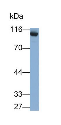 Monoclonal Antibody to Angiotensin I Converting Enzyme 2 (ACE2)
