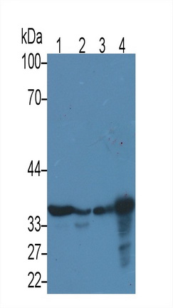 Monoclonal Antibody to Glyceraldehyde-3-Phosphate Dehydrogenase (GAPDH)