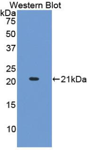 Monoclonal Antibody to Collagen Type XV (COL15)