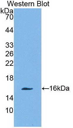 Monoclonal Antibody to Charcot Leyden Crystal Protein (CLC)