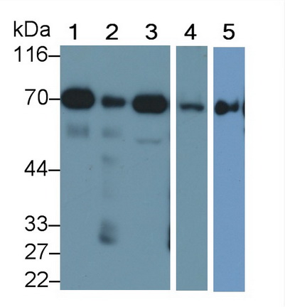 Monoclonal Antibody to Succinate Dehydrogenase Complex Subunit A (SDHA)