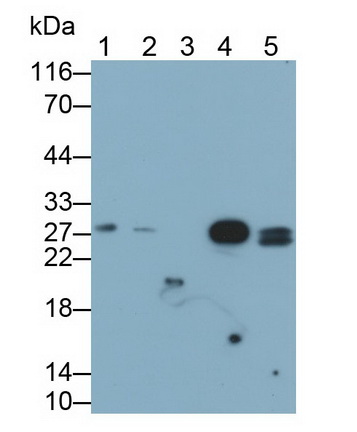 Monoclonal Antibody to Ependymin Related Protein 1 (EPDR1)