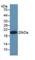 Polyclonal Antibody to Erythropoietin (EPO)