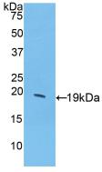 Polyclonal Antibody to Colony Stimulating Factor 3, Granulocyte (GCSF)
