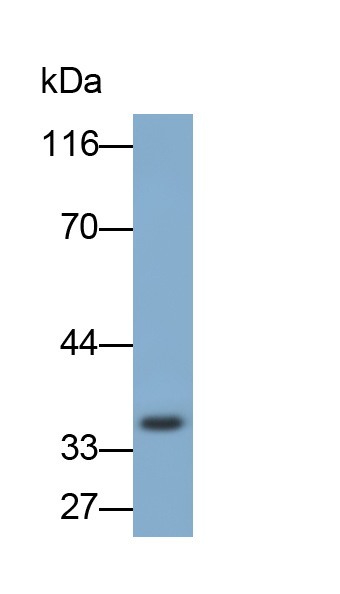 Polyclonal Antibody to Insulin Like Growth Factor Binding Protein 2 (IGFBP2)