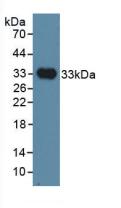 Polyclonal Antibody to Inhibin Binding Protein (INHBP)