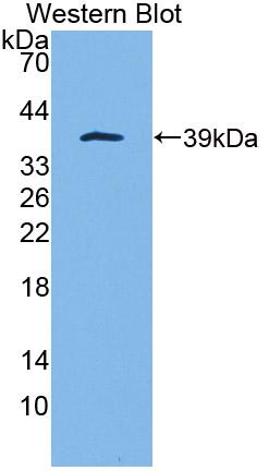 Polyclonal Antibody to Complement Component 5a (C5a)