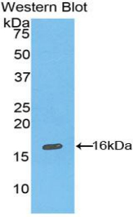 Polyclonal Antibody to Inhibin A (INHA)