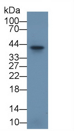 Polyclonal Antibody to Inhibin A (INHA)