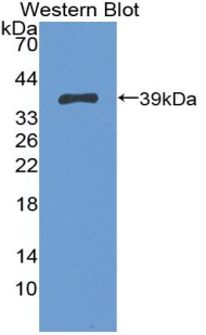 Polyclonal Antibody to Trophoblast Glycoprotein (TPBG)