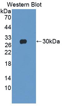 Polyclonal Antibody to Troponin I Type 3, Cardiac (TNNI3)