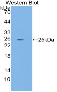 Polyclonal Antibody to Laminin Alpha 1 (LAMA1)