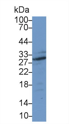 Polyclonal Antibody to Adiponectin (ADP)