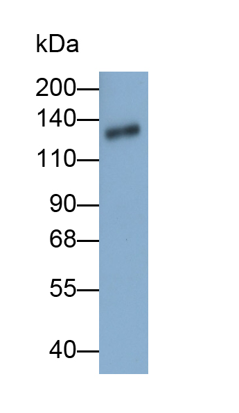 Polyclonal Antibody to Thrombospondin 1 (THBS1)