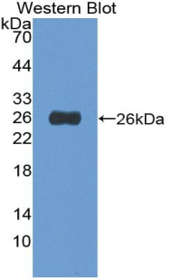Polyclonal Antibody to Tachykinin Receptor 2 (TACR2)